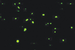 Ubiquitin Antibody in Immunohistochemistry (IHC)