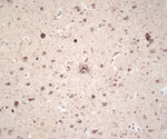 Ubiquitin Antibody in Immunohistochemistry (IHC)