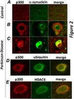 Ubiquitin Antibody in Immunocytochemistry (ICC/IF)