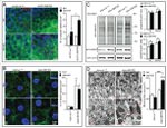 Ubiquitin Antibody in Immunohistochemistry (IHC)