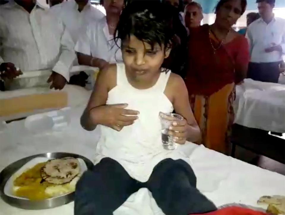 Video footage showed her clutching a glass of water, and doctors said she has learnt to walk on two legs