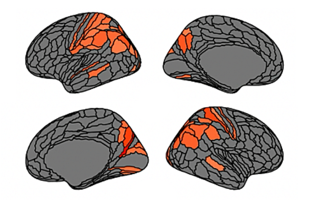 Research image of regional structural differences in the brains of neurodiverse people.