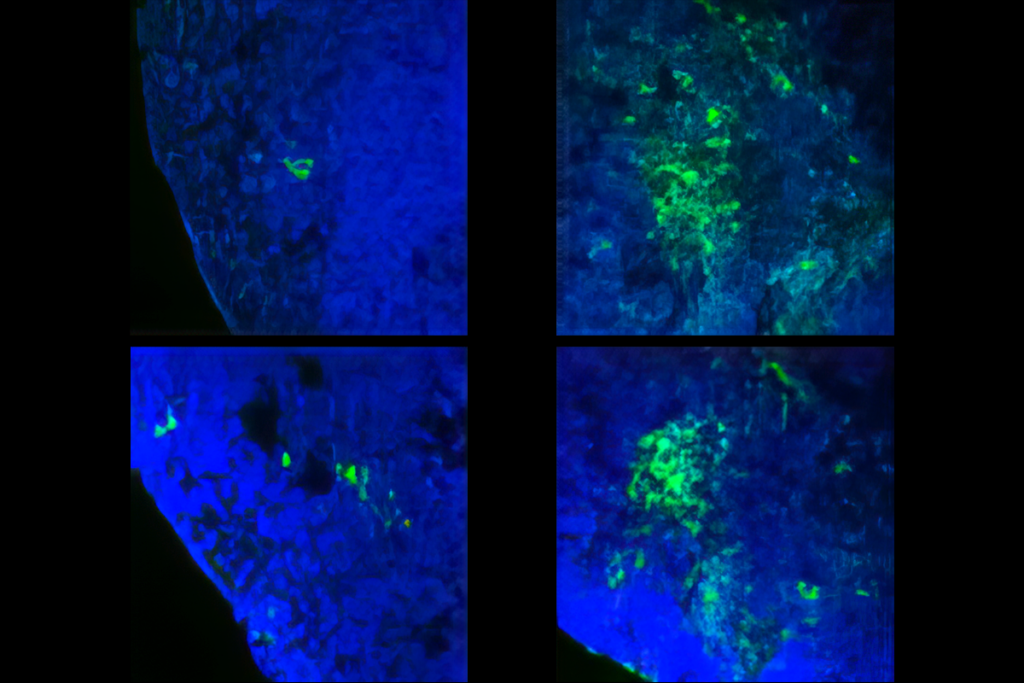 Research image of brain organoids with astroglia formation represented in green.