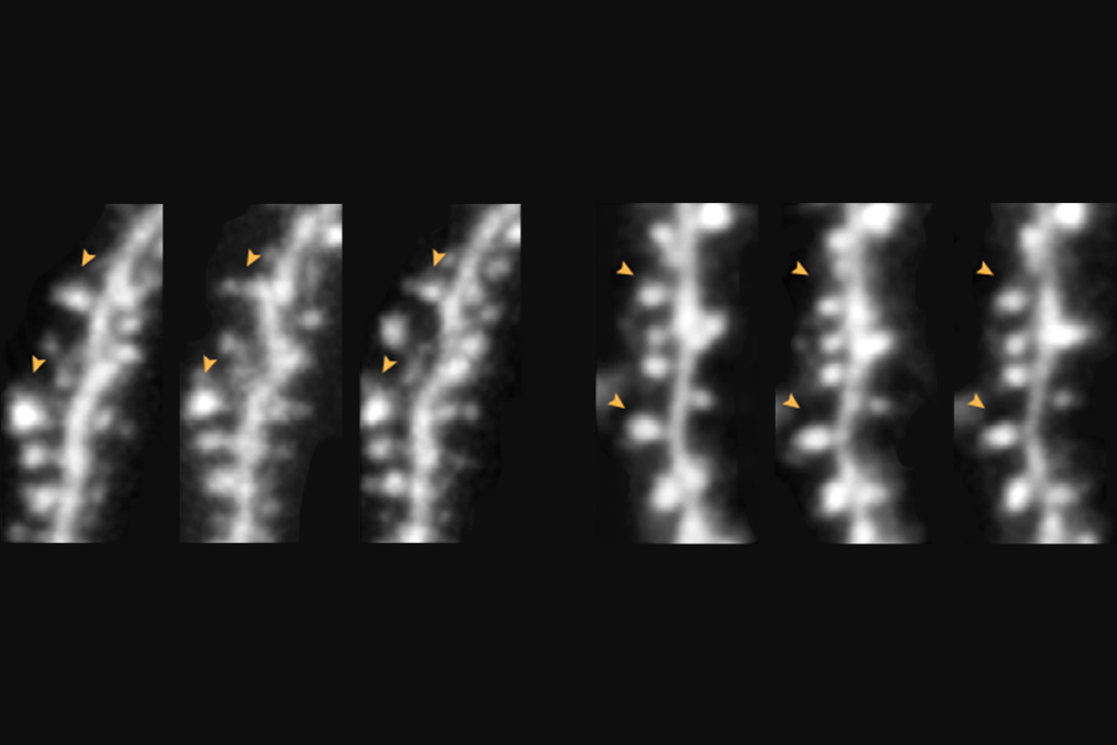 Dendritic spine images.