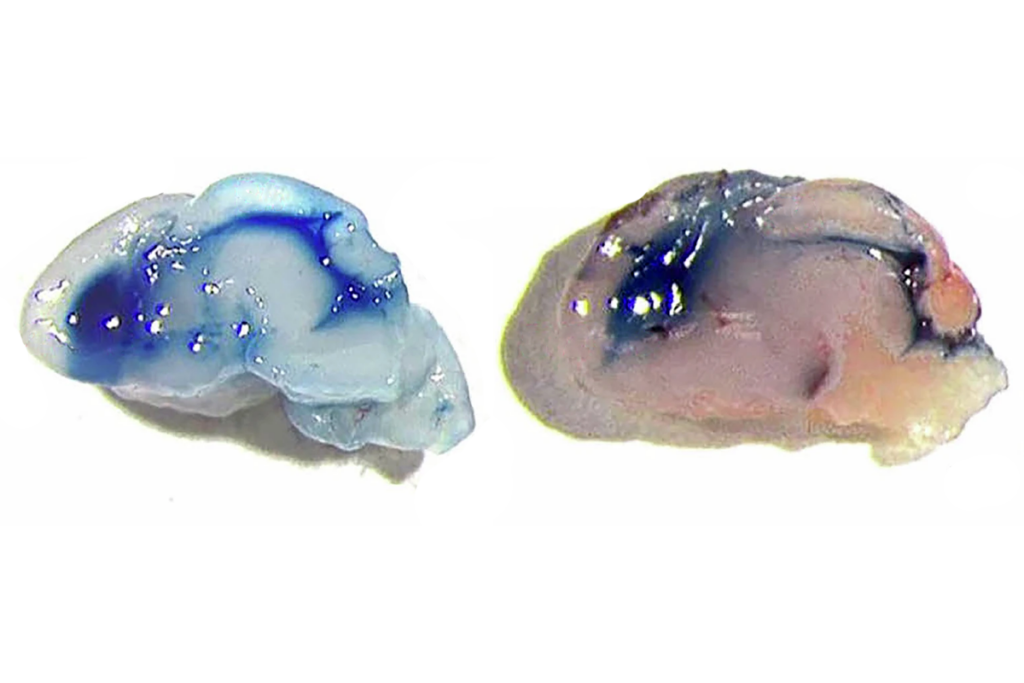 Research image of enlarged brain ventricles in a mouse model of hydrocephalus.