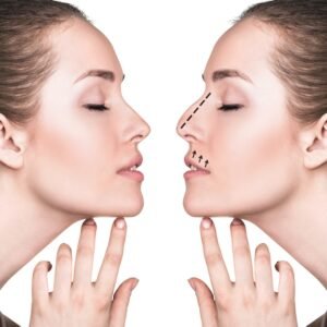 Rhinoplasty Techniques, Explained