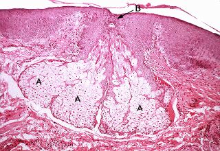 Sebaceous Glands Histology