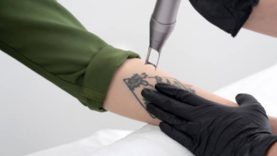 5 Common Myths and Misconceptions About Tattoo Removal