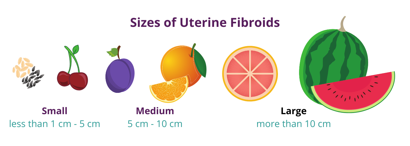 Uterine Fibroid Size Chart In Mm