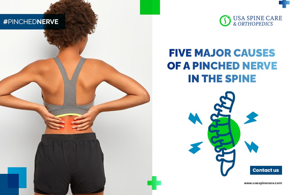 Five Major Causes Of A Pinched Nerve In The Spine Usa Spine Care | My ...