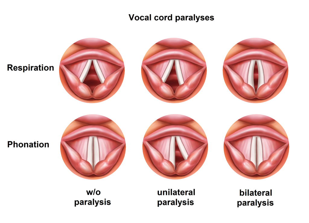 Diagram Of Vocal Cords