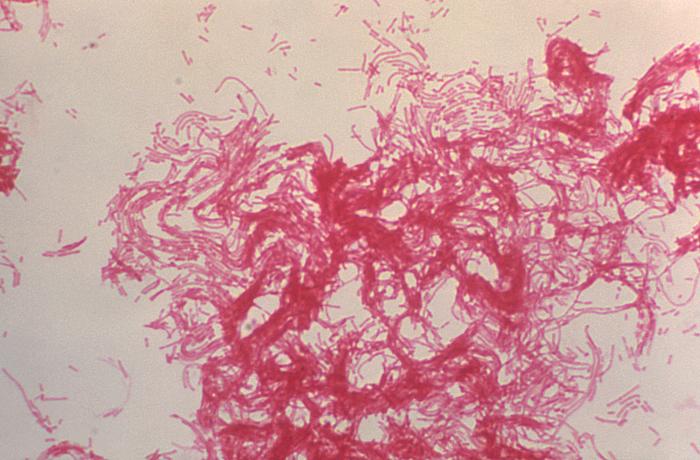 Haemophilus ducreyi - wikidoc