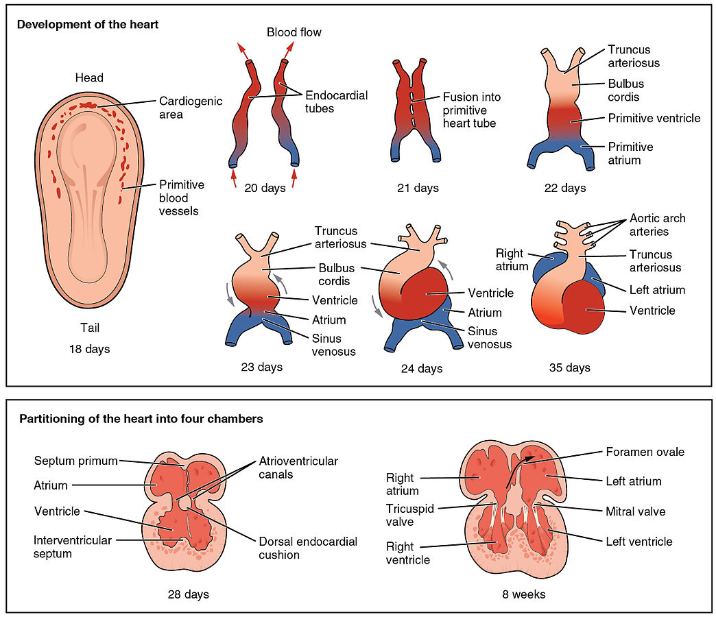 Tetralogy of Fallot pathophysiology - wikidoc