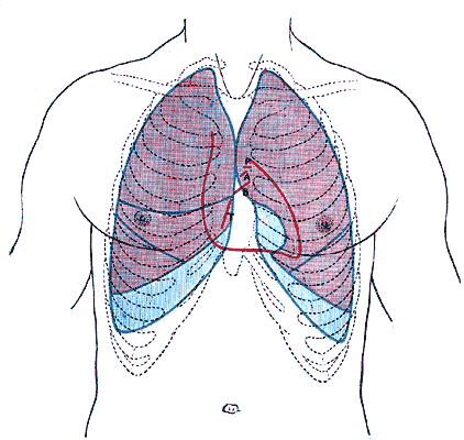 Front of thorax, showing surface relations of bones, lungs (purple), pleura (blue), and heart (red outline). Heart valves are labeled with "B", "T", "A", and "P".