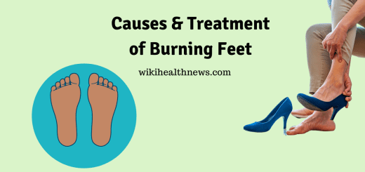 Burning feet