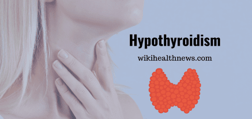 Hypothyroidism