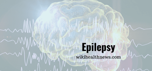 Epilepsy