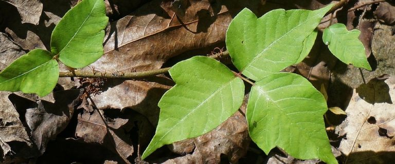 Retro WON: 8 Things I Learned From A Bad Case Of Poison Ivy