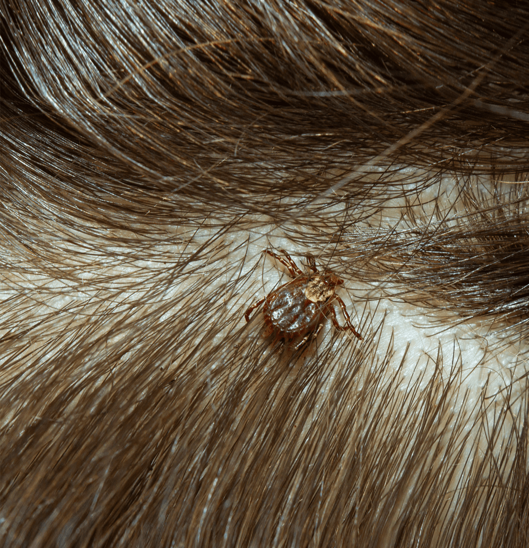 Tick Fever in Dogs: Find Out Ways to Protect and Prevent! - Blog