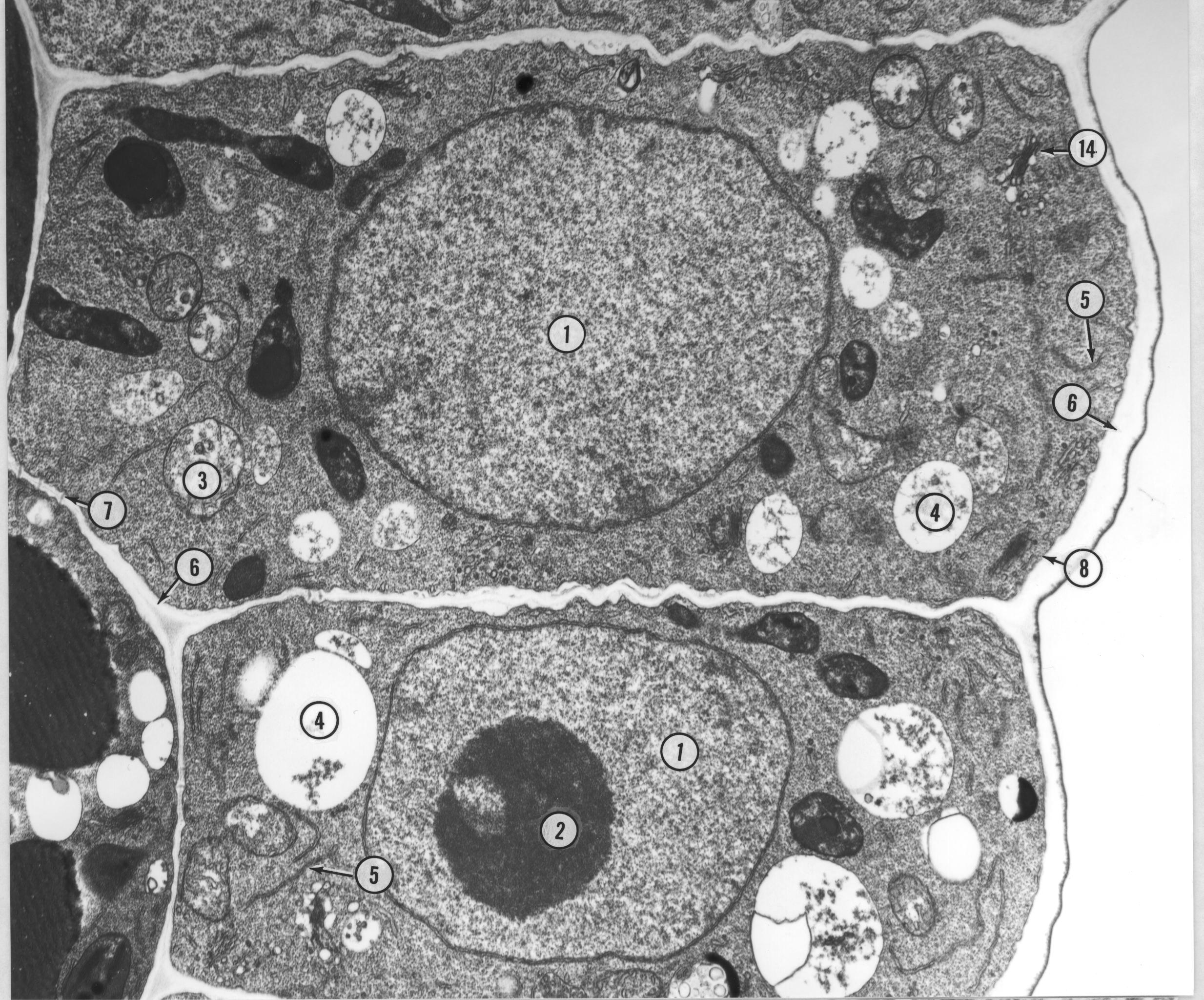 Plant Cells Under An Electron Microscope