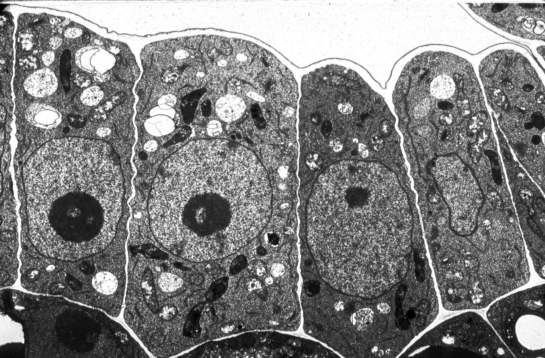 Plant Cells Under An Electron Microscope