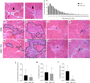 Duchenne muscular dystrophy progression induced by downhill running is ...