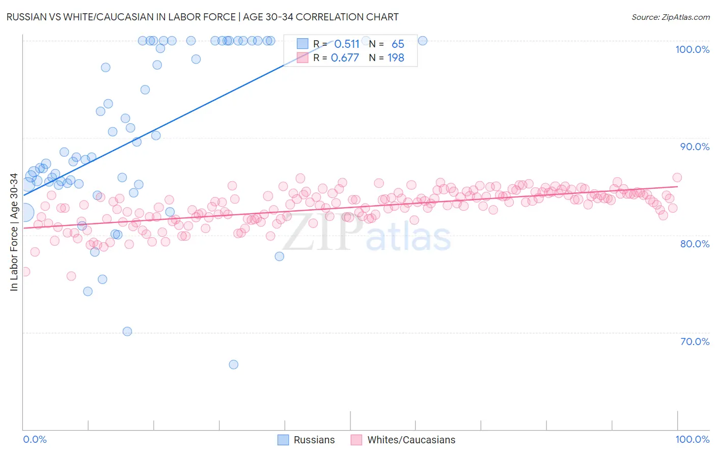 Russian vs White/Caucasian In Labor Force | Age 30-34